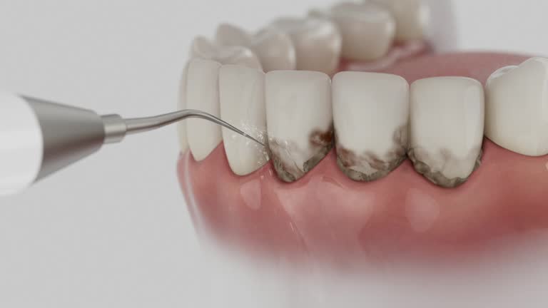 Reliable Dental contractor in Huntingdon, TN by Dentist Open Now
